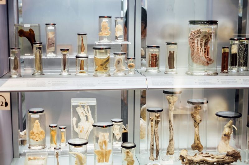 On the Grid : Hunterian Museum